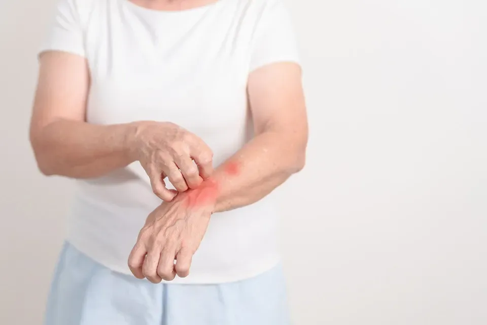 Boletins Epidemiológicos analisam perfil de novos casos e hospitalizações por hanseníase no Brasil