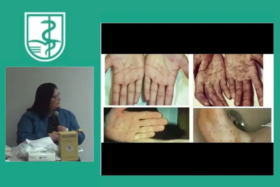 IESAPM promove aula sobre sífilis para alunos da graduação, em alusão ao Outubro Verde